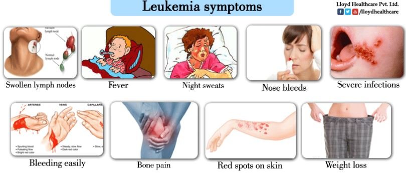 Leukemia symptoms