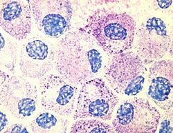 Mast Cell Tumor