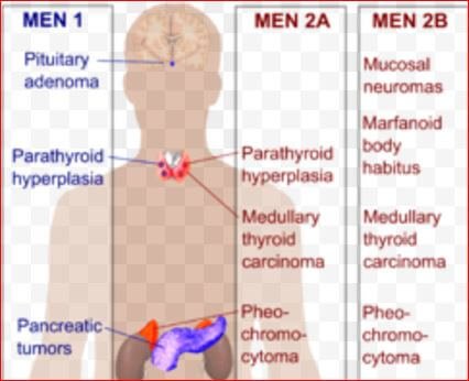 Multiple Endocrine Neoplasia Picture 2