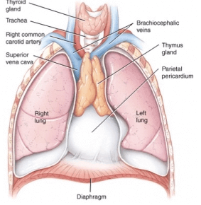 Thymoma